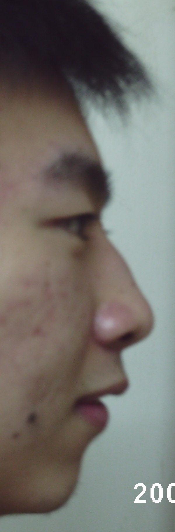xia ba 2
